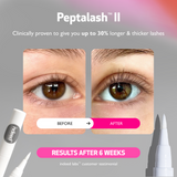 peptalash™  II