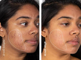 pH-In™ The Cleanser - Indeed laboratories