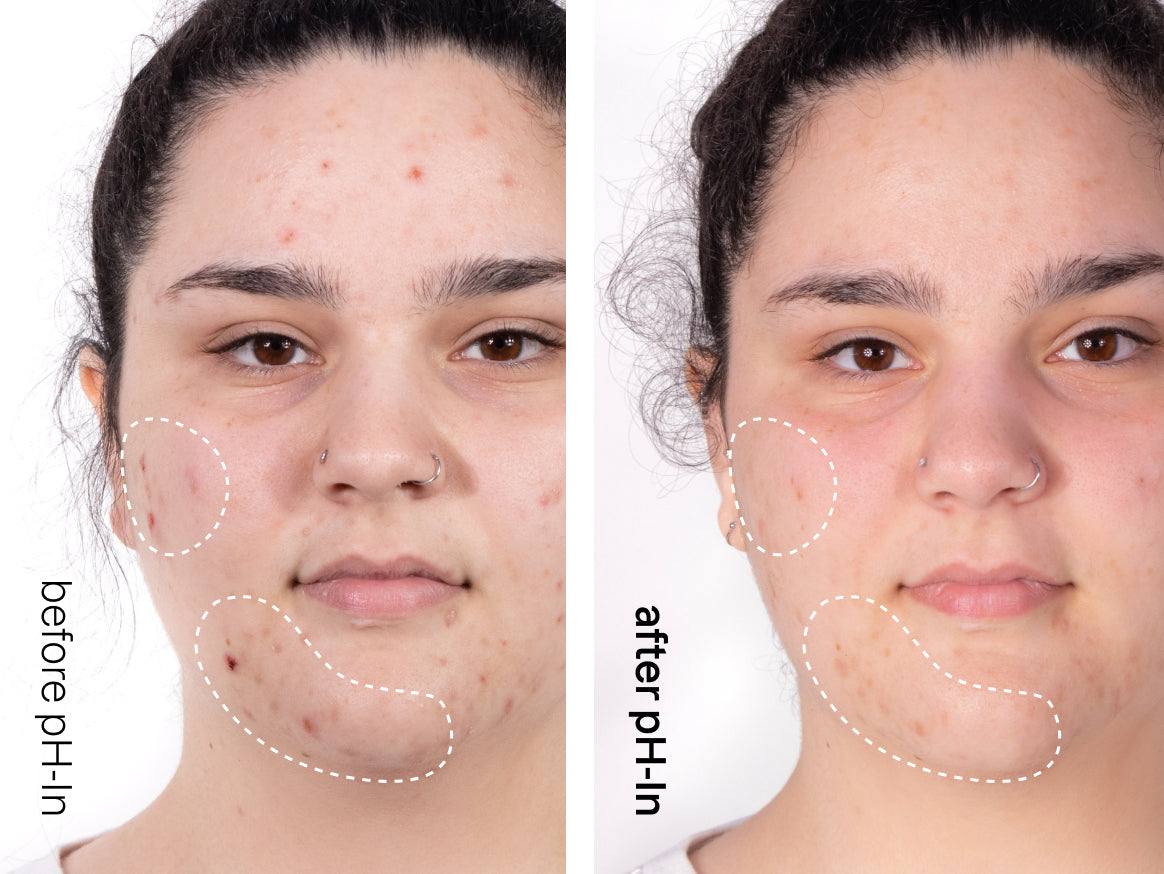 pH-In™ The Cleanser - Indeed laboratories