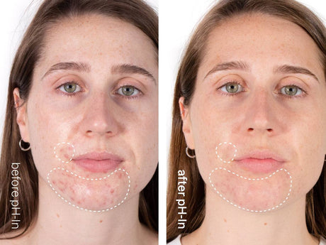 pH-In™ The Cleanser - Indeed laboratories