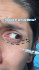 snoxin™  II under eye patches